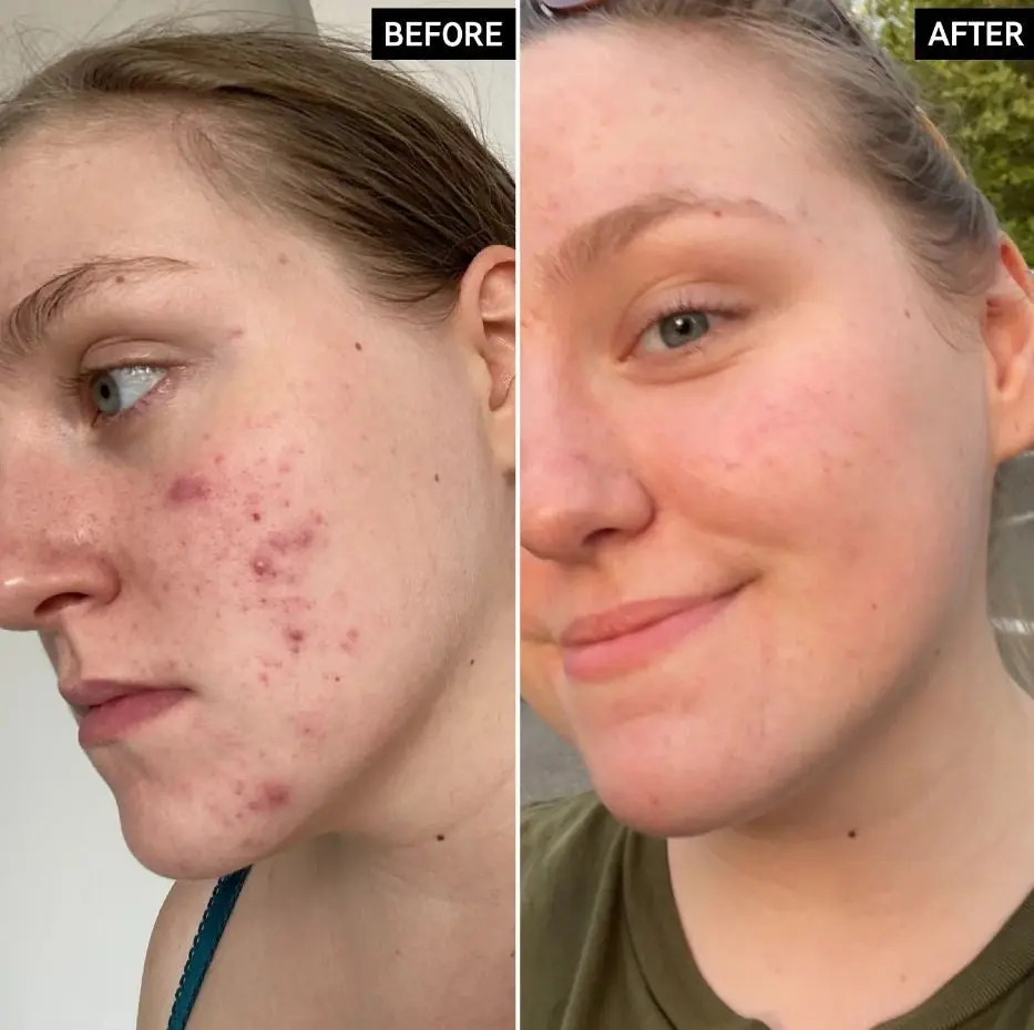 Glycolic Acid Toner - Image 3