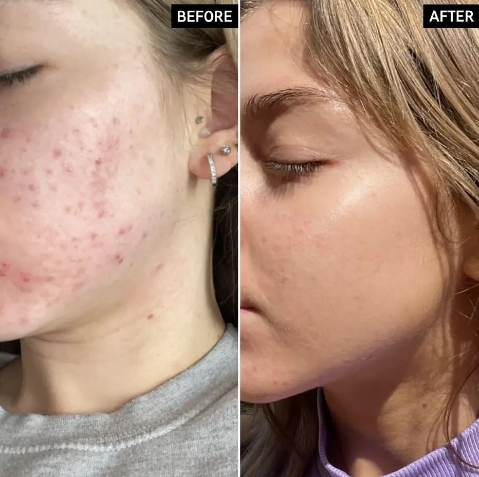 Niacinamide Serum - Image 3