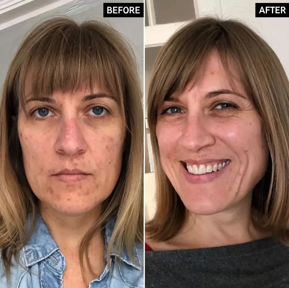Retinol Serum - Image 3