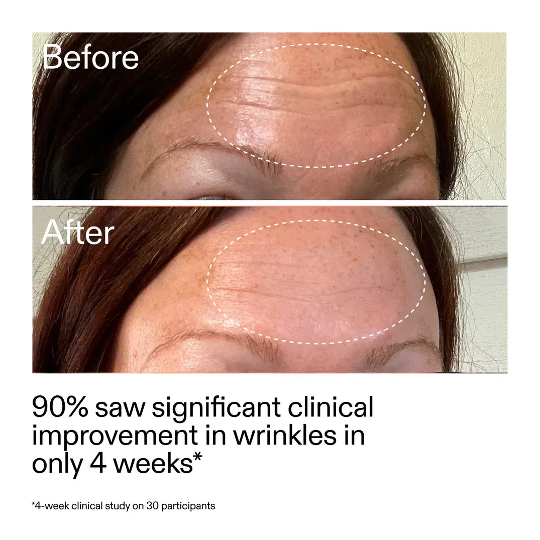 Starter Retinol Serum - Image 3