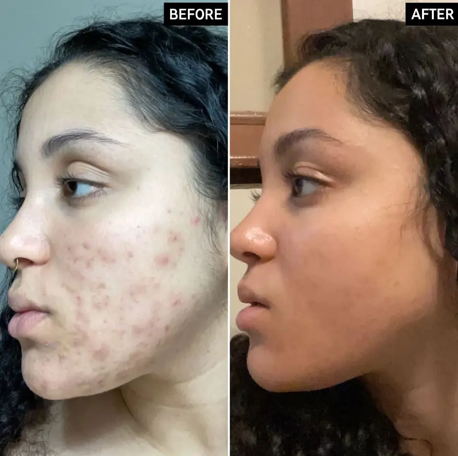 Vitamin C Serum - Image 3