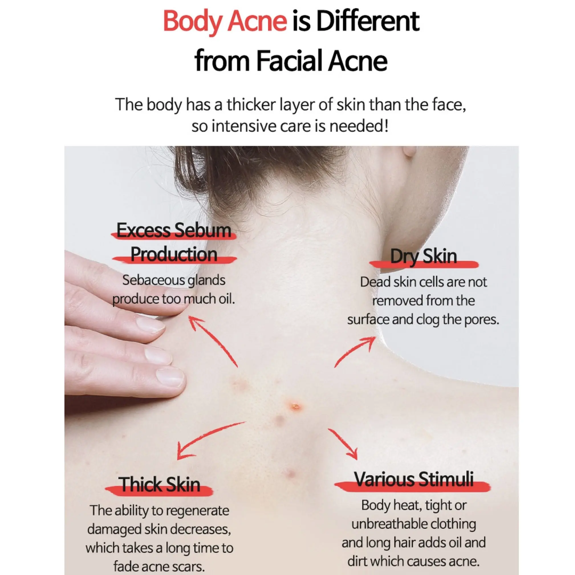 Anti-blemish Body Lotion - Image 2