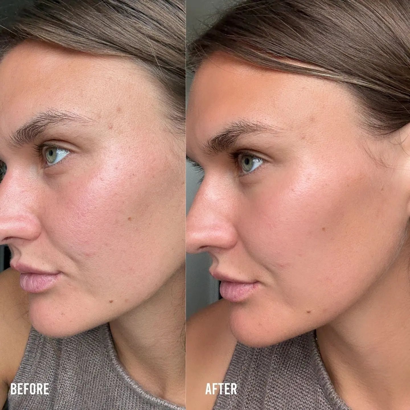 The H-A + Deep Moisture Face Tan - Image 3