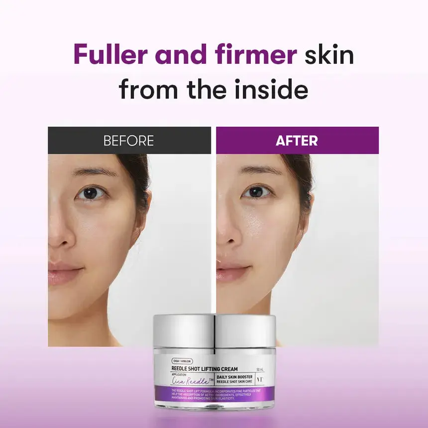 Reedle Shot Lifting Cream - Image 3