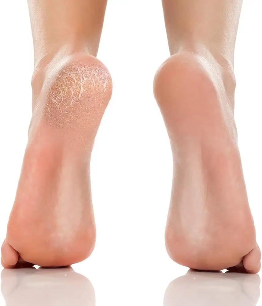 Argan Oil Foot Pack - Image 3